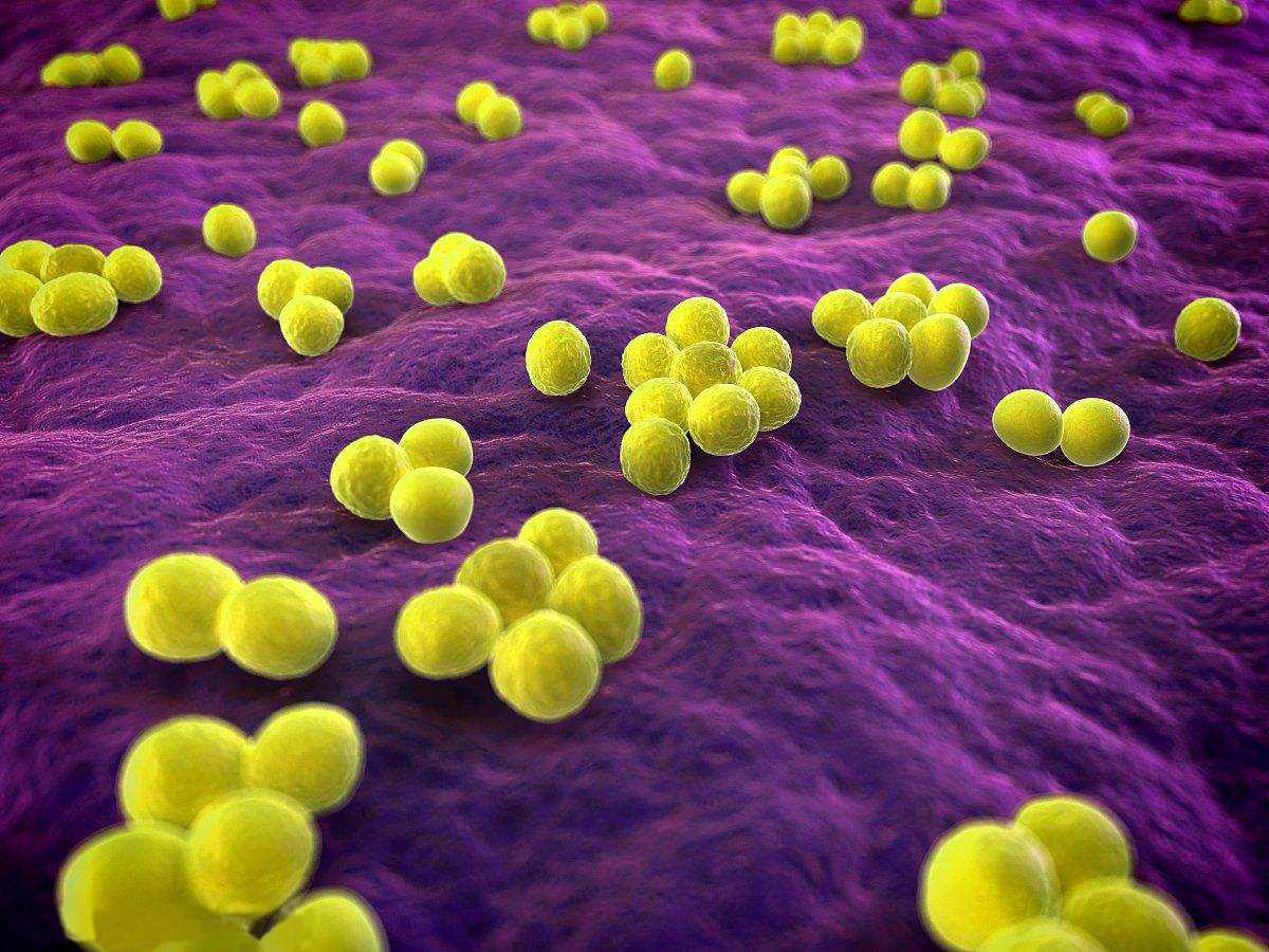 MRSA Super Bacteria